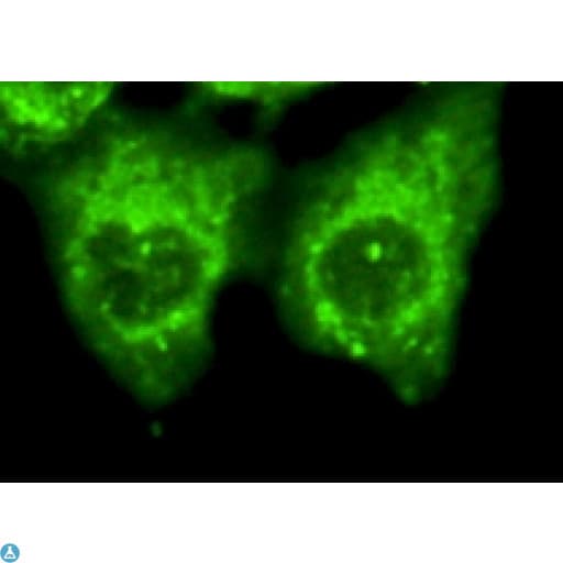 ARRB2 / Beta Arrestin 2 Antibody