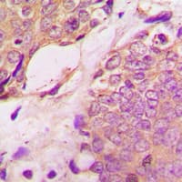 Polyclonal Rabbit anti-Human SREBF1 / SREBP-1 Antibody (phospho-Ser439, IHC, WB)