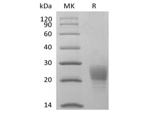Cynomolgus PVRIG Protein (Recombinant 6His, C-terminus)