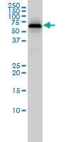 PGM1 / Phosphoglucomutase 1 Antibody (clone 3B8-H4)