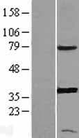 PTGR1 / LTB4DH Protein (Over-Expression Lysate Myc-DDK (Flag))