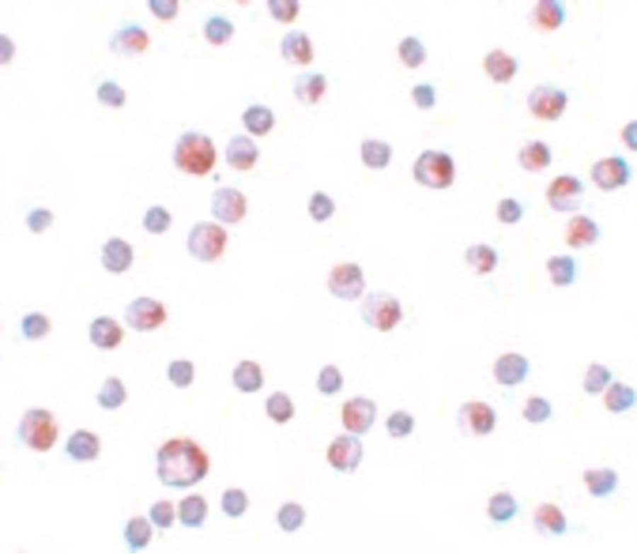 TCTN3 Antibody