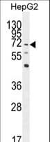 NRROS / LRRC33 Antibody (aa611-640)