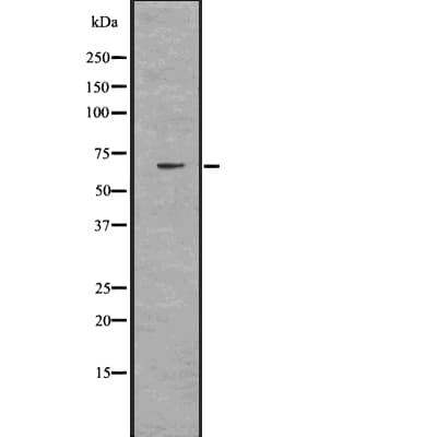 SLC27A1 / FATP Antibody