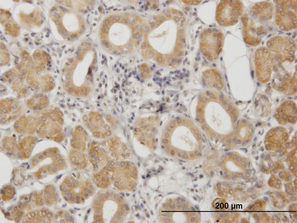 Monoclonal Mouse anti-Human PRKAR2A Antibody (clone 6A9, IHC, IF, WB)