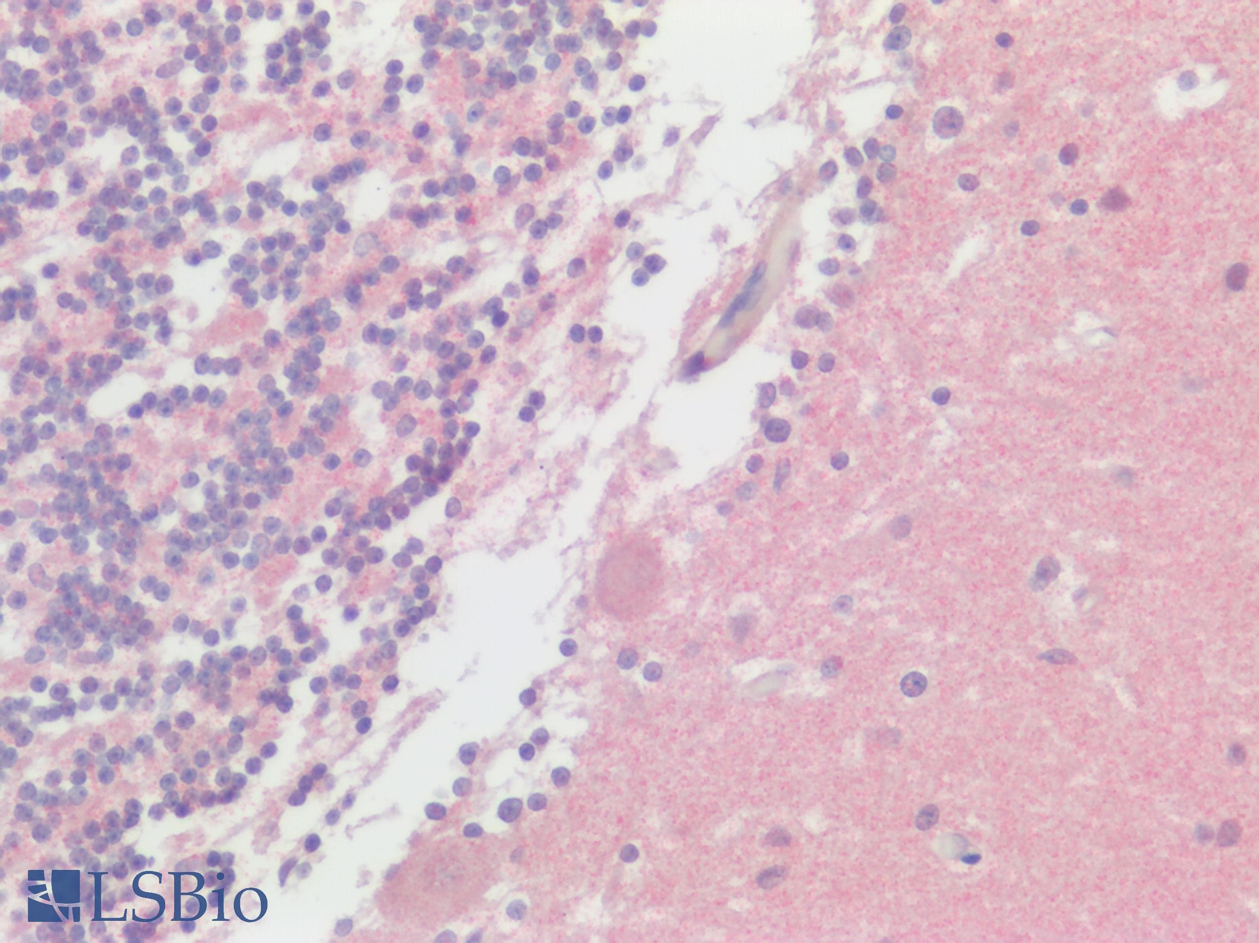 IHC-plus™ Polyclonal Rabbit anti-Human GPR75 Antibody (N-Terminus, IHC)