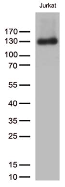 PECAM-1 / CD31 Antibody (clone UMAB29)