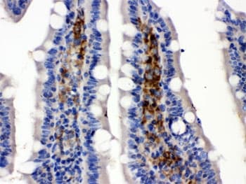 Polyclonal Rabbit anti-Human SLC2A5 / GLUT5 Antibody (IHC, WB)