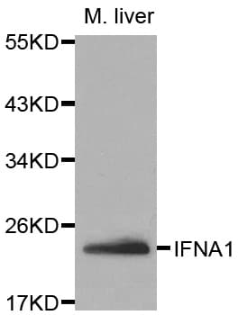 Polyclonal Rabbit anti-Human IFNA1 / Interferon Alpha 1 Antibody (IF, WB)
