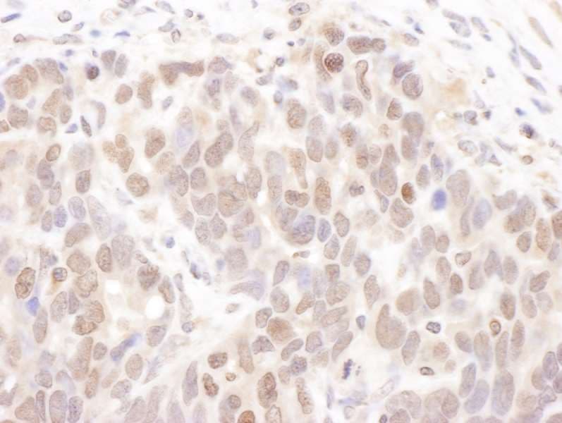 CSNK2A1 Antibody (aa350-C-term)