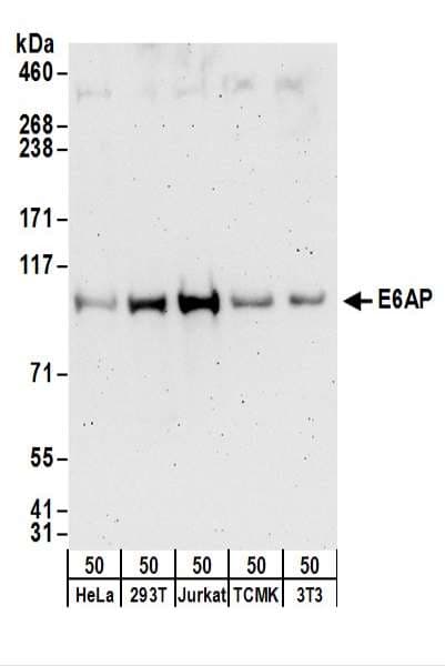 E6AP / UBE3A Antibody (aa75-125)