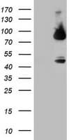 Monoclonal Mouse anti-Human F13A1 / Factor XIIIa Antibody (clone OTI3G12, IHC, WB)