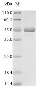 Plasmodium falciparum MSP1 Protein (Recombinant 10His, N-terminus)