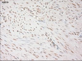 VEGFA / VEGF Antibody (clone OTI2F7)