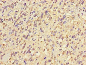 NIM1K / NIM1 Antibody