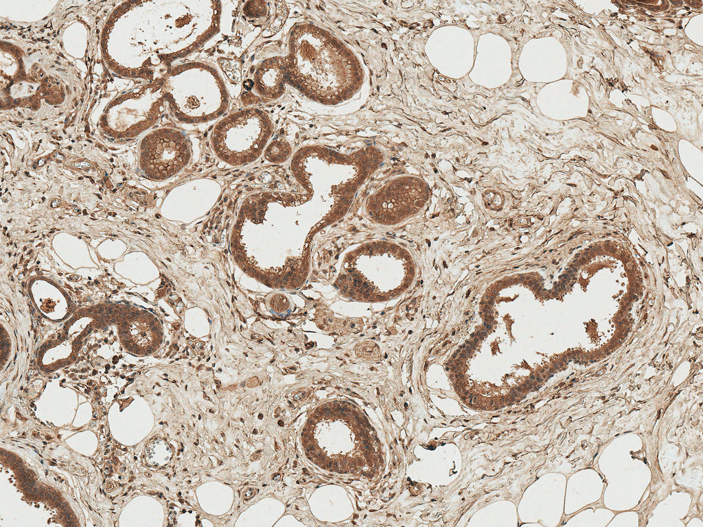 AXIN1 / Axin-1 Antibody (APC)