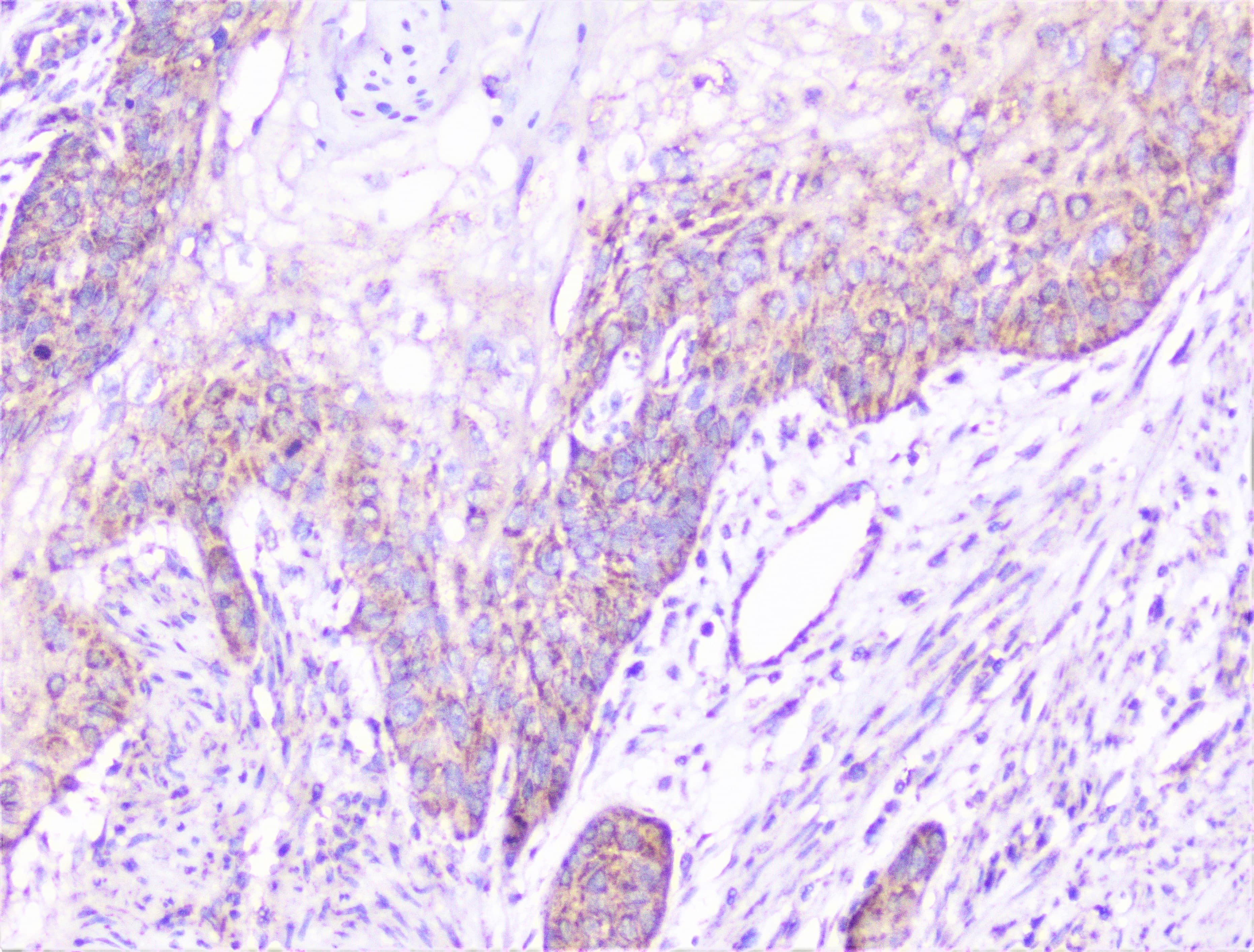 CTTN / Cortactin Antibody