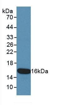 KRT15 / CK15 / Cytokeratin 15 Antibody (aa274-399)