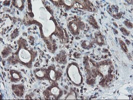 Monoclonal Mouse anti-Human SKIL / SNO / SnoN Antibody (clone OTI3E2, IHC, WB)