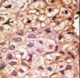 ACE2 / ACE-2 Antibody (aa59-90)