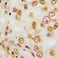 MKI67 / Ki67 Antibody