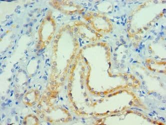 PRMT1 Antibody (aa20-353)