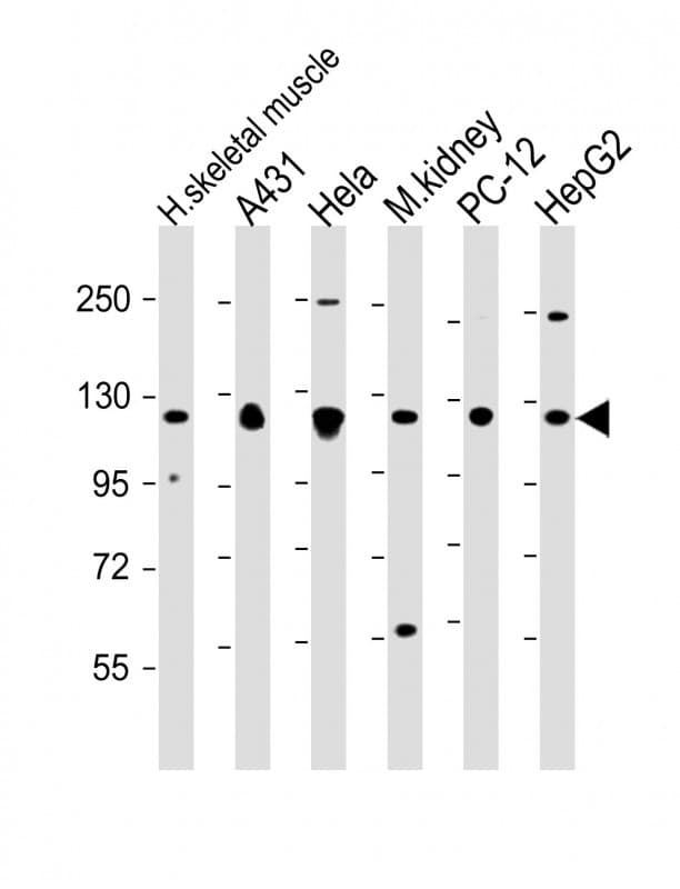 VCL / Vinculin Antibody