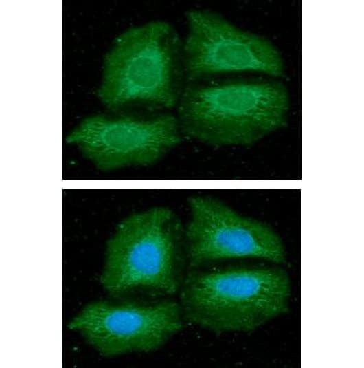 NMT1 Antibody (clone AT2C8)