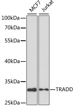 TRADD Antibody