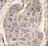 Polyclonal Rabbit anti-Human B2M / Beta 2 Microglobulin Antibody (aa86-118, IHC, WB)