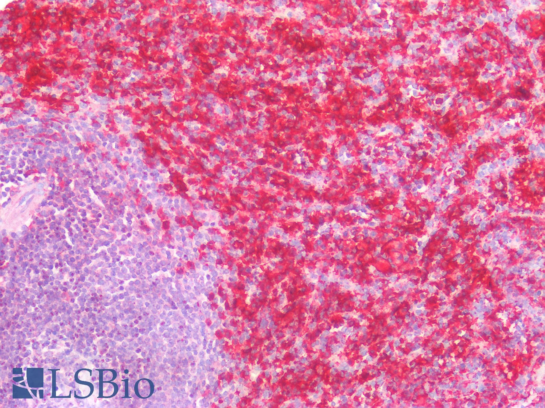 IHC-plus™ FCER1G Antibody