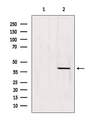 Polyclonal Rabbit anti-Human ATP6AP2 / Renin Receptor Antibody (IHC, IF, WB)