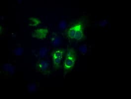 LIPG / Endothelial Lipase Antibody (clone OTI6E11)
