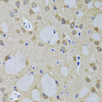 YWHAZ / 14-3-3 Zeta Antibody