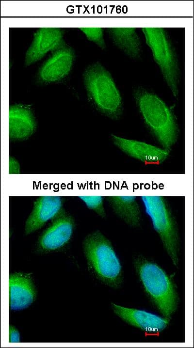 IHC-plus™ CKB / Creatine Kinase BB Antibody (aa165-381)