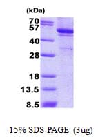Human LPCAT1 / AYTL2 Protein (Recombinant His)