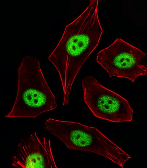 Polyclonal Rabbit anti-Human CDKN1A / WAF1 / p21 Antibody (aa133-164, IF, WB)