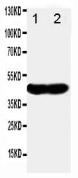 Polyclonal Rabbit anti-Human NDRG1 Antibody (aa194-214, IHC, WB)