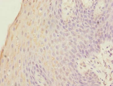 FOXP1 Antibody