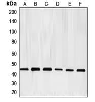 Polyclonal Rabbit anti-Human E2F4 Antibody (Internal, IHC, WB)