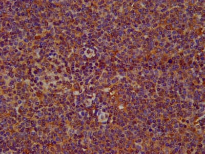 Polyclonal Rabbit anti-Human SERPINB12 Antibody