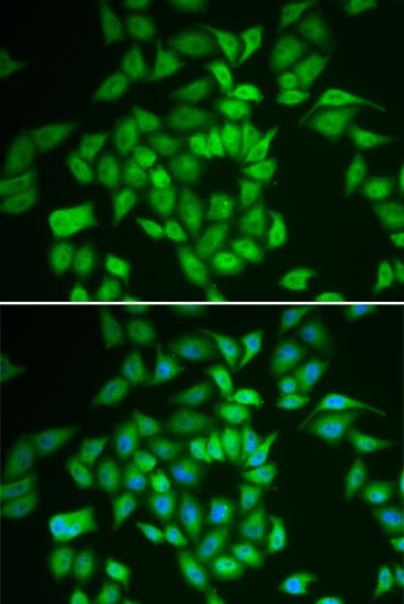 CSNK1E / CK1 Epsilon Antibody