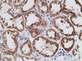 PECR Antibody (clone OTI1C9)