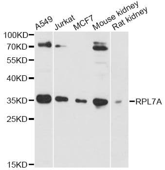 RPL7A / Ribosomal Protein L7a Antibody