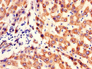 Polyclonal Rabbit anti-Human KBTBD6 Antibody (IHC, IF, WB)