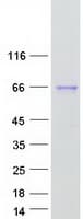 Human ALPPL2 Protein (Recombinant Myc-DDK (Flag))