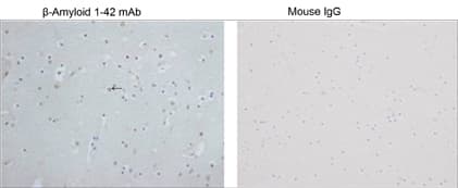 Beta Amyloid 1-42 Antibody
