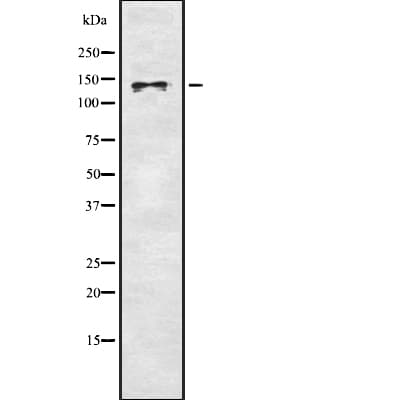 MCAM / CD146 Antibody