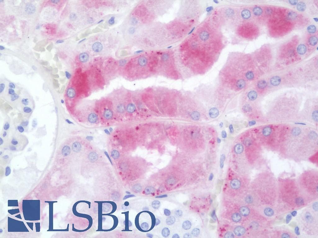 IHC-plus™ CLDN16 / Claudin 16 Antibody (aa6-33)