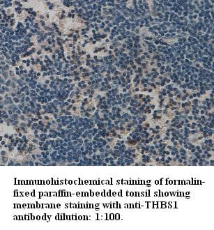 THBS1 / Thrombospondin-1 Antibody (Internal)